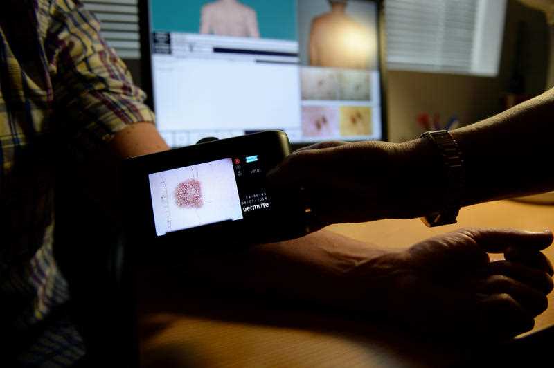 a patient being checked for skin cancers at a skin cancer clinic