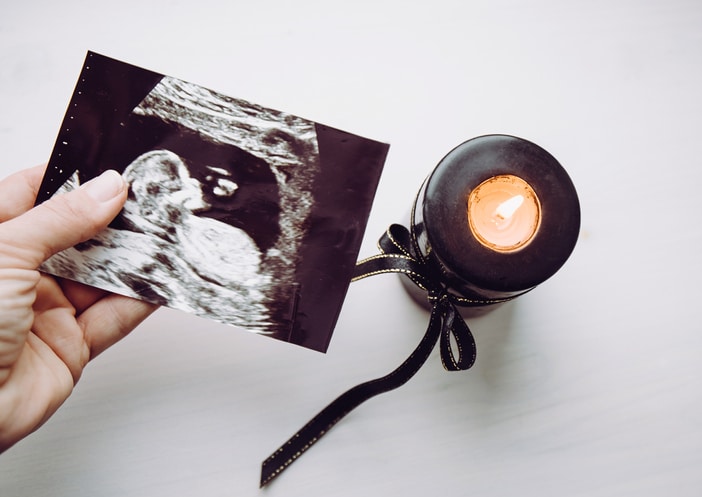 Mother hand holding ultrasound picture of baby, beside a black candle burning.